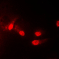 CSNK1E / CK1 Epsilon Antibody - Immunofluorescent analysis of CK1 epsilon staining in HEK293T cells. Formalin-fixed cells were permeabilized with 0.1% Triton X-100 in TBS for 5-10 minutes and blocked with 3% BSA-PBS for 30 minutes at room temperature. Cells were probed with the primary antibody in 3% BSA-PBS and incubated overnight at 4 C in a humidified chamber. Cells were washed with PBST and incubated with a DyLight 594-conjugated secondary antibody (red) in PBS at room temperature in the dark. DAPI was used to stain the cell nuclei (blue).
