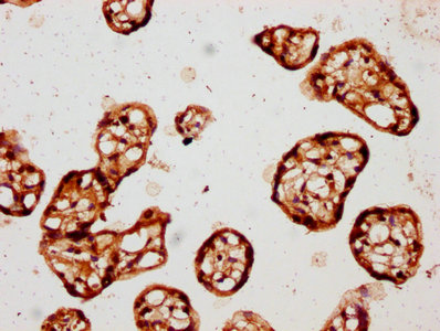 CSNK1E / CK1 Epsilon Antibody - IHC image of CSNK1E Antibody diluted at 1:150 and staining in paraffin-embedded human placenta tissue performed on a Leica BondTM system. After dewaxing and hydration, antigen retrieval was mediated by high pressure in a citrate buffer (pH 6.0). Section was blocked with 10% normal goat serum 30min at RT. Then primary antibody (1% BSA) was incubated at 4°C overnight. The primary is detected by a biotinylated secondary antibody and visualized using an HRP conjugated SP system.