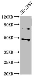 CSNK1E / CK1 Epsilon Antibody - Western Blot Positive WB detected in: SH-SY5Y whole cell lysate All lanes: CSNK1E antibody at 3µg/ml Secondary Goat polyclonal to rabbit IgG at 1/50000 dilution Predicted band size: 48 kDa Observed band size: 48 kDa
