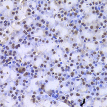 CSNK1E / CK1 Epsilon Antibody - Immunohistochemistry of paraffin-embedded rat pancreas.