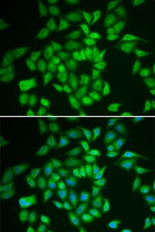 CSNK1E / CK1 Epsilon Antibody - Immunofluorescence analysis of HeLa cells.