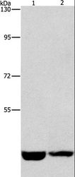 CSNK1E / CK1 Epsilon Antibody - Western blot analysis of HeLa and A431 cell, using CSNK1E Polyclonal Antibody at dilution of 1:1550.