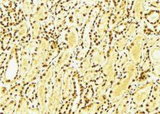 CSNK1E / CK1 Epsilon Antibody - 1:100 staining mouse kidney tissue by IHC-P. The sample was formaldehyde fixed and a heat mediated antigen retrieval step in citrate buffer was performed. The sample was then blocked and incubated with the antibody for 1.5 hours at 22°C. An HRP conjugated goat anti-rabbit antibody was used as the secondary.