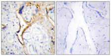 CSNK1E / CK1 Epsilon Antibody - Peptide - + Immunohistochemistry analysis of paraffin-embedded human placenta tissue using CKI-e antibody.