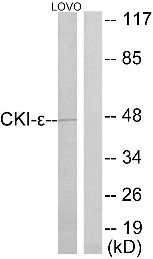 CSNK1E / CK1 Epsilon Antibody - Western blot analysis of extracts from LOVO cells, using CKI-e antibody.