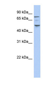 CSNK1E / CK1 Epsilon Antibody - CSNK1E antibody Western blot of THP-1 cell lysate. This image was taken for the unconjugated form of this product. Other forms have not been tested.
