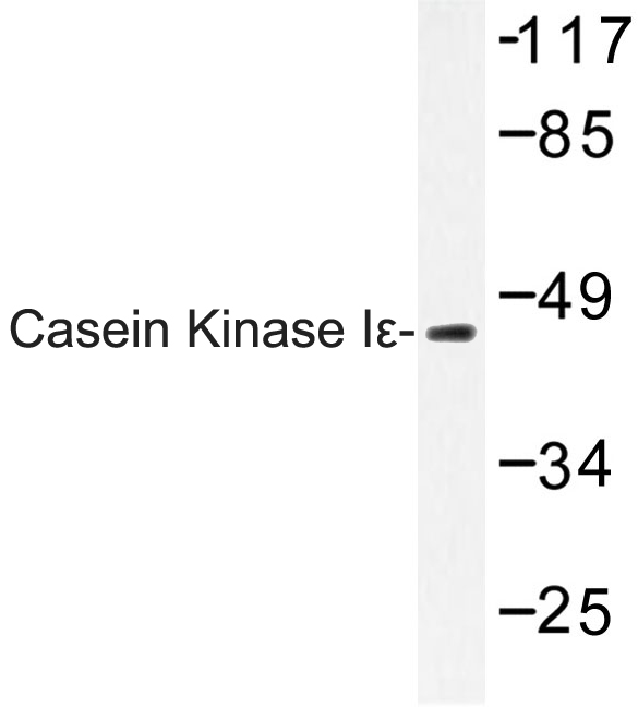 CSNK1E / CK1 Epsilon Antibody - Western blot of Casein Kinase I (P301) pAb in extracts from LOVO cells.