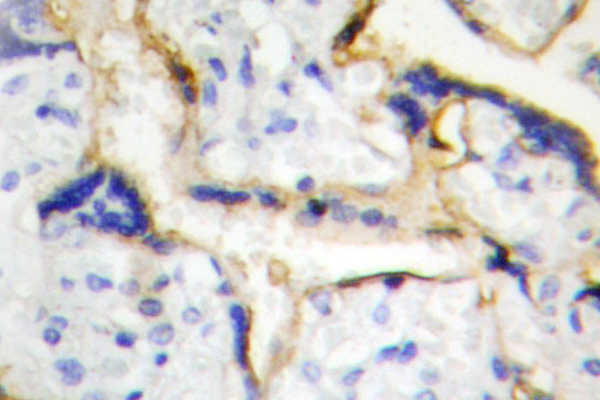 CSNK1E / CK1 Epsilon Antibody - IHC of Casein Kinase I (P301) pAb in paraffin-embedded human placenta tissue.