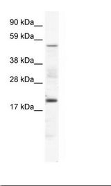 CSNK1G1 / CKI-Gamma 1 Antibody - SP2/0 Cell Lysate.  This image was taken for the unconjugated form of this product. Other forms have not been tested.