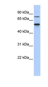 CSNK1G1 / CKI-Gamma 1 Antibody - CSNK1G1 antibody Western blot of Mouse Thymus lysate. This image was taken for the unconjugated form of this product. Other forms have not been tested.