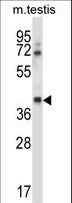 CSNK1G1 / CKI-Gamma 1 Antibody - Mouse Csnk1g1 Antibody western blot of mouse testis tissue lysates (35 ug/lane). The Csnk1g1 antibody detected the Csnk1g1 protein (arrow).