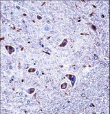 CSNK1G1 / CKI-Gamma 1 Antibody - Mouse Csnk1g1 Antibody immunohistochemistry of formalin-fixed and paraffin-embedded mouse brain tissue followed by peroxidase-conjugated secondary antibody and DAB staining.This data demonstrates the use of Mouse Csnk1g1 Antibody for immunohistochemistry.