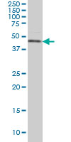CSNK1G1 / CKI-Gamma 1 Antibody - CSNK1G1 monoclonal antibody (M02), clone 2E10 Western blot of CSNK1G1 expression in HeLa NE.