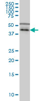 CSNK1G1 / CKI-Gamma 1 Antibody - CSNK1G1 monoclonal antibody (M01), clone 3D1 Western blot of CSNK1G1 expression in HeLa NE.