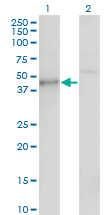 CSNK1G1 / CKI-Gamma 1 Antibody - Western blot of CSNK1G1 expression in transfected 293T cell line by CSNK1G1 monoclonal antibody (M01), clone 3D1.