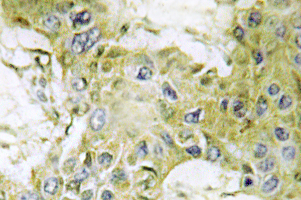 CSNK1G1 / CKI-Gamma 1 Antibody - IHC of Casein Kinase I1 (H3) pAb in paraffin-embedded human brain tissue.