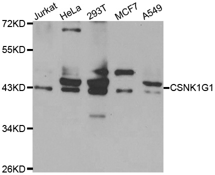 CSNK1G1 / CKI-Gamma 1 Antibody - Western blot analysis of extracts of various cell lines.