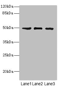 CSNK1G1 / CKI-Gamma 1 Antibody - Western blot All Lanes: CSNK1G1antibody at 1.13ug/ml Lane 1 : Jurkat whole cell lysate Lane 2 : Hela whole cell lysate Lane 3 : MCF7 whole cell lysate Secondary Goat polyclonal to Rabbit IgG at 1/10000 dilution Predicted band size: 49,46 kDa Observed band size: 49 kDa