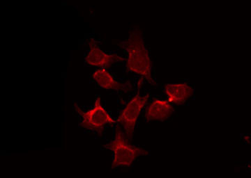 CSNK1G1 / CKI-Gamma 1 Antibody - Staining COS7 cells by IF/ICC. The samples were fixed with PFA and permeabilized in 0.1% Triton X-100, then blocked in 10% serum for 45 min at 25°C. The primary antibody was diluted at 1:200 and incubated with the sample for 1 hour at 37°C. An Alexa Fluor 594 conjugated goat anti-rabbit IgG (H+L) Ab, diluted at 1/600, was used as the secondary antibody.