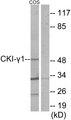 CSNK1G1 / CKI-Gamma 1 Antibody - Western blot analysis of extracts from COS-7 cells, using CKI-?1 antibody.