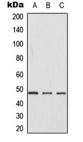 CSNK1G1 / CKI-Gamma 1 Antibody - Western blot analysis of CK1 gamma 1 expression in Jurkat (A); NIH3T3 (B); H9C2 (C) whole cell lysates.