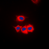 CSNK1G1 / CKI-Gamma 1 Antibody - Immunofluorescent analysis of CK1 gamma 1 staining in Jurkat cells. Formalin-fixed cells were permeabilized with 0.1% Triton X-100 in TBS for 5-10 minutes and blocked with 3% BSA-PBS for 30 minutes at room temperature. Cells were probed with the primary antibody in 3% BSA-PBS and incubated overnight at 4 C in a humidified chamber. Cells were washed with PBST and incubated with a DyLight 594-conjugated secondary antibody (red) in PBS at room temperature in the dark. DAPI was used to stain the cell nuclei (blue).