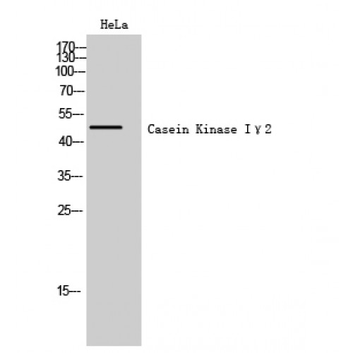 CSNK1G2 / CKI-Gamma 2 Antibody - Western blot of Casein Kinase Igamma2 antibody