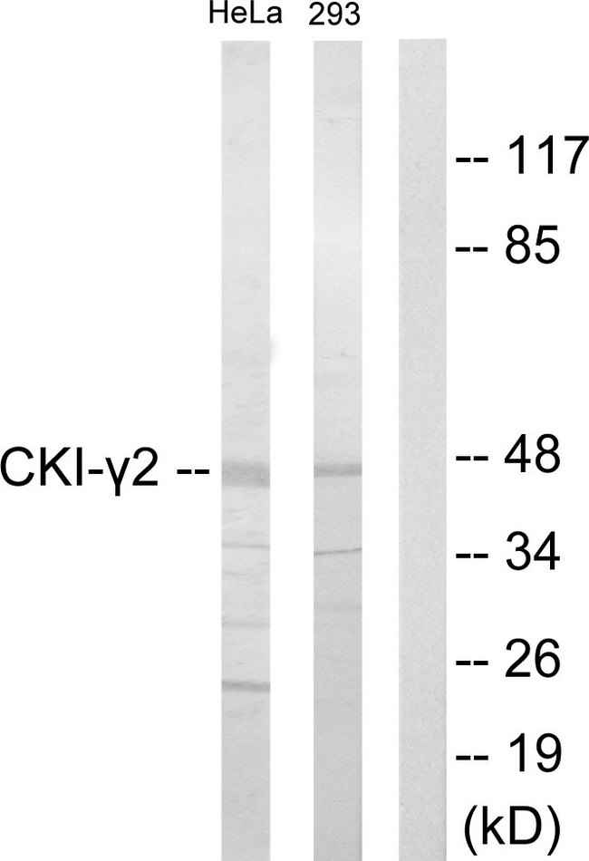 CSNK1G2 / CKI-Gamma 2 Antibody - Western blot analysis of lysates from HeLa and 293 cells, using CKI-gamma2 Antibody. The lane on the right is blocked with the synthesized peptide.