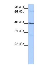 CSNK1G2 / CKI-Gamma 2 Antibody - HEPG2 cell lysate. Antibody concentration: 0.5 ug/ml. Gel concentration: 12%.  This image was taken for the unconjugated form of this product. Other forms have not been tested.