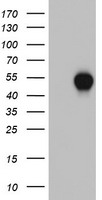 CSNK1G2 / CKI-Gamma 2 Antibody - HEK293T cells were transfected with the pCMV6-ENTRY control (Left lane) or pCMV6-ENTRY CSNK1G2 (Right lane) cDNA for 48 hrs and lysed. Equivalent amounts of cell lysates (5 ug per lane) were separated by SDS-PAGE and immunoblotted with anti-CSNK1G2.