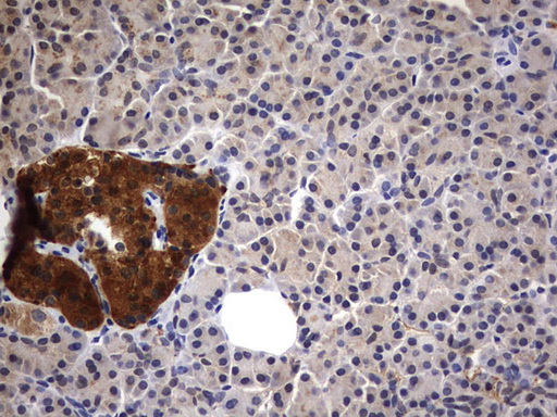 CSNK1G2 / CKI-Gamma 2 Antibody - IHC of paraffin-embedded Human pancreas tissue using anti-CSNK1G2 mouse monoclonal antibody. (Heat-induced epitope retrieval by 1 mM EDTA in 10mM Tris, pH8.5, 120°C for 3min).
