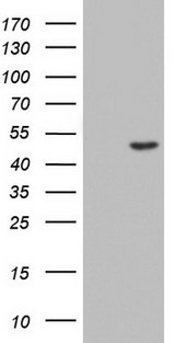 CSNK1G2 / CKI-Gamma 2 Antibody - HEK293T cells were transfected with the pCMV6-ENTRY control (Left lane) or pCMV6-ENTRY CSNK1G2 (Right lane) cDNA for 48 hrs and lysed. Equivalent amounts of cell lysates (5 ug per lane) were separated by SDS-PAGE and immunoblotted with anti-CSNK1G2.