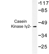 CSNK1G2 / CKI-Gamma 2 Antibody - Western blot of Casein Kinase I2 (G7) pAb in extracts from HeLa cells.