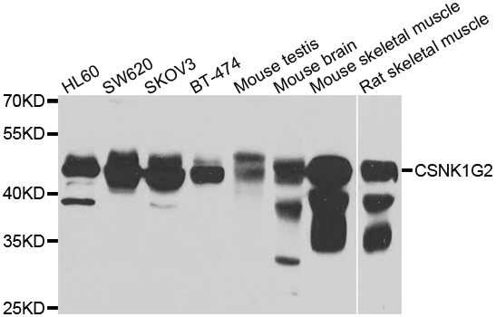 CSNK1G2 / CKI-Gamma 2 Antibody - Western blot analysis of extracts of various cell lines.