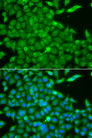 CSNK1G2 / CKI-Gamma 2 Antibody - Immunofluorescence analysis of A549 cells.