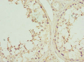 CSNK1G2 / CKI-Gamma 2 Antibody - Immunohistochemistry of paraffin-embedded human testis tissue at dilution 1:100