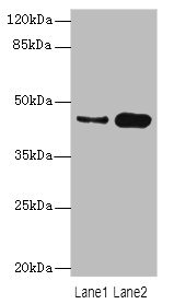 CSNK1G2 / CKI-Gamma 2 Antibody - Western blot All Lanes: CSNK1G2antibody at 4.21ug/ml Lane 1 : Mouse gonadal tissue Lane 2 : Hela whole cell lysate Secondary Goat polyclonal to Rabbit IgG at 1/10000 dilution Predicted band size: 47 kDa Observed band size: 47 kDa