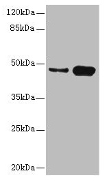 CSNK1G2 / CKI-Gamma 2 Antibody - Western blot All lanes: CSNK1G2 antibody at 4.21µg/ml Lane 1: Mouse gonadal tissue Lane 2: Hela whole cell lysate Secondary Goat polyclonal to rabbit IgG at 1/10000 dilution Predicted band size: 47 kDa Observed band size: 47 kDa