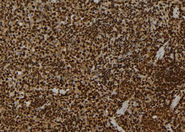 CSNK1G2 / CKI-Gamma 2 Antibody - 1:100 staining mouse spleen tissue by IHC-P. The sample was formaldehyde fixed and a heat mediated antigen retrieval step in citrate buffer was performed. The sample was then blocked and incubated with the antibody for 1.5 hours at 22°C. An HRP conjugated goat anti-rabbit antibody was used as the secondary.