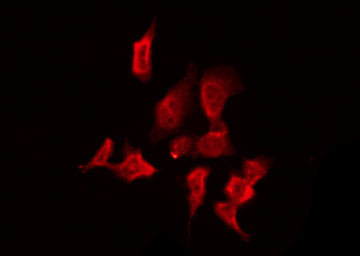 CSNK1G2 / CKI-Gamma 2 Antibody - Staining HeLa cells by IF/ICC. The samples were fixed with PFA and permeabilized in 0.1% Triton X-100, then blocked in 10% serum for 45 min at 25°C. The primary antibody was diluted at 1:200 and incubated with the sample for 1 hour at 37°C. An Alexa Fluor 594 conjugated goat anti-rabbit IgG (H+L) Ab, diluted at 1/600, was used as the secondary antibody.