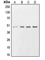 CSNK1G2 / CKI-Gamma 2 Antibody - Western blot analysis of CK1 gamma 2 expression in HeLa (A); Raw264.7 (B); PC12 (C); rat heart (D) whole cell lysates.