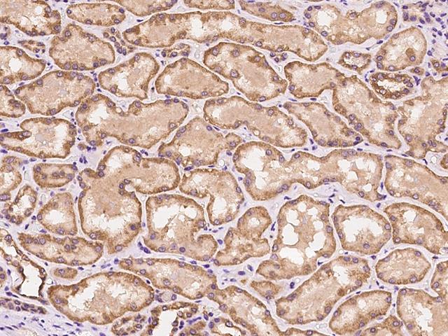 CSNK1G2 / CKI-Gamma 2 Antibody - Immunochemical staining of human CSNK1G2 in human kidney with rabbit polyclonal antibody at 1:200 dilution, formalin-fixed paraffin embedded sections.