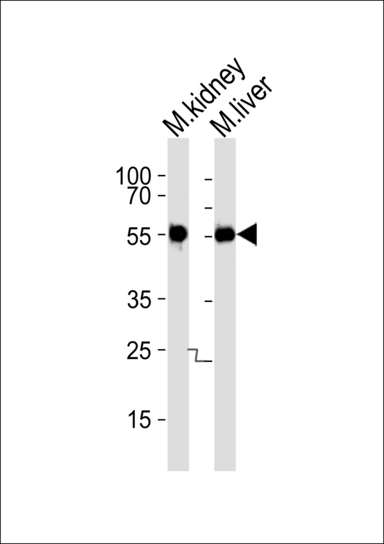 CSNK1G3 / CKI-Gamma 3 Antibody - Western blot of lysates from mouse kidney and liver tissue lysate (from left to right), using Mouse Csnk1g3 Antibody. Antibody was diluted at 1:1000 at each lane. A goat anti-rabbit IgG H&L (HRP) at 1:5000 dilution was used as the secondary antibody. Lysates at 35ug per lane.