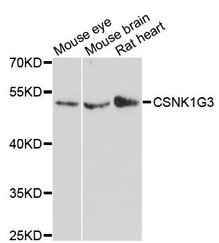 CSNK1G3 / CKI-Gamma 3 Antibody - Western blot analysis of extracts of various cell lines, using CSNK1G3 antibody at 1:3000 dilution. The secondary antibody used was an HRP Goat Anti-Rabbit IgG (H+L) at 1:10000 dilution. Lysates were loaded 25ug per lane and 3% nonfat dry milk in TBST was used for blocking. An ECL Kit was used for detection and the exposure time was 90s.