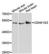 CSNK1G3 / CKI-Gamma 3 Antibody - Western blot analysis of extracts of various cell lines, using CSNK1G3 antibody at 1:3000 dilution. The secondary antibody used was an HRP Goat Anti-Rabbit IgG (H+L) at 1:10000 dilution. Lysates were loaded 25ug per lane and 3% nonfat dry milk in TBST was used for blocking. An ECL Kit was used for detection and the exposure time was 90s.