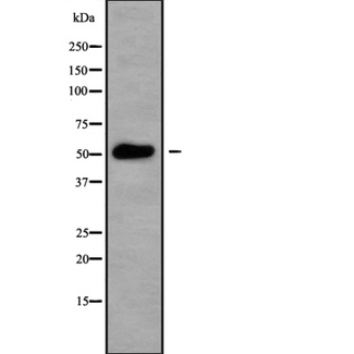 CSNK1G3 / CKI-Gamma 3 Antibody - Western blot analysis of CSNK1G3 using HuvEc whole cells lysates