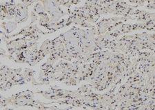 CSNK1G3 / CKI-Gamma 3 Antibody - 1:100 staining human lung tissue by IHC-P. The sample was formaldehyde fixed and a heat mediated antigen retrieval step in citrate buffer was performed. The sample was then blocked and incubated with the antibody for 1.5 hours at 22°C. An HRP conjugated goat anti-rabbit antibody was used as the secondary.