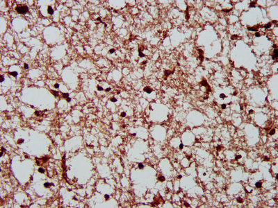CSNK2A1 Antibody - IHC image of CSNK2A1 Antibody diluted at 1:300 and staining in paraffin-embedded human brain tissue performed on a Leica BondTM system. After dewaxing and hydration, antigen retrieval was mediated by high pressure in a citrate buffer (pH 6.0). Section was blocked with 10% normal goat serum 30min at RT. Then primary antibody (1% BSA) was incubated at 4°C overnight. The primary is detected by a biotinylated secondary antibody and visualized using an HRP conjugated SP system.