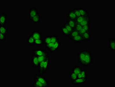 CSNK2A1 Antibody - Immunofluorescent analysis of HepG2 cells using CSNK2A1 Antibody at dilution of 1:100 and Alexa Fluor 488-congugated AffiniPure Goat Anti-Rabbit IgG(H+L)