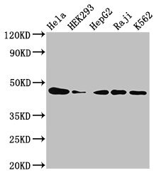 CSNK2A1 Antibody - Western Blot Positive WB detected in: Hela whole cell lysate, HEK293 whole cell lysate, HepG2 whole cell lysate, Raji whole cell lysate, K562 whole cell lysate All lanes: CSNK2A1 antibody at 3µg/ml Secondary Goat polyclonal to rabbit IgG at 1/50000 dilution Predicted band size: 46, 30 kDa Observed band size: 46 kDa